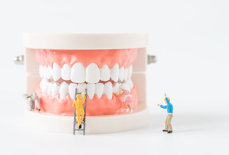 Invisalign