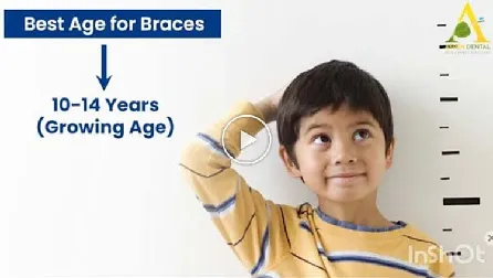 Ideal age to visit orthodontist in Delhi? Can Braces/Invisalign be done at any age?